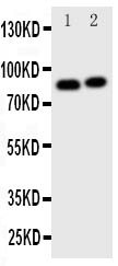 WB - Anti-Gelsolin Antibody ABO11415